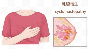 什么是乳腺增生？